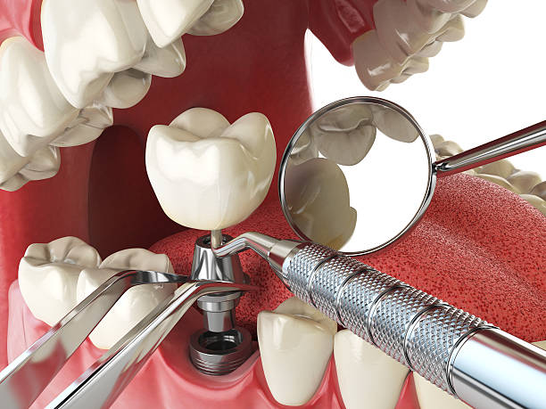 Best Emergency Orthodontic Repairs in Edinburg, VA